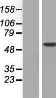 TKFC / DAK Protein - Western validation with an anti-DDK antibody * L: Control HEK293 lysate R: Over-expression lysate