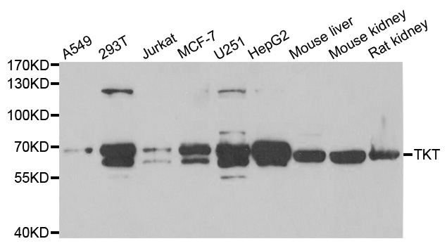 TKT / Transketolase Antibody - Western blot analysis of extracts of various cell lines.