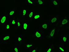 TKT / Transketolase Antibody - Immunofluorescence staining of TKT in HeLa cells. Cells were fixed with 4% PFA, permeabilzed with 0.1% Triton X-100 in PBS, blocked with 10% serum, and incubated with rabbit anti-Human TKT polyclonal antibody (dilution ratio 1:1000) at 4°C overnight. Then cells were stained with the Alexa Fluor 488-conjugated Goat Anti-rabbit IgG secondary antibody (green). Positive staining was localized to nucleus.