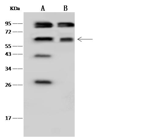 TKT / Transketolase Antibody - Anti-TKT rabbit polyclonal antibody at 1:500 dilution. Lane A: HepG2 Whole Cell Lysate. Lane B: HeLa Whole Cell Lysate. Lysates/proteins at 30 ug per lane. Secondary: Goat Anti-Rabbit IgG (H+L)/HRP at 1/10000 dilution. Developed using the ECL technique. Performed under reducing conditions. Predicted band size: 68 kDa. Observed band size: 68 kDa. (We are unsure as to the identity of these extra bands.)
