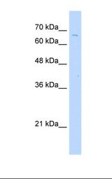TKTL2 Antibody - Jurkat cell lysate. Antibody concentration: 2.5 ug/ml. Gel concentration: 12%.  This image was taken for the unconjugated form of this product. Other forms have not been tested.
