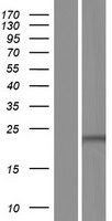 TLCD1 Protein - Western validation with an anti-DDK antibody * L: Control HEK293 lysate R: Over-expression lysate