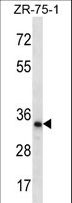 TLCD2 Antibody - TLCD2 Antibody western blot of ZR-75-1 cell line lysates (35 ug/lane). The TLCD2 antibody detected the TLCD2 protein (arrow).
