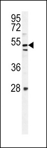 TLDC1 / KIAA1609 Antibody - K1609 Antibody western blot of mouse NIH-3T3 cell line lysates (35 ug/lane). The K1609 antibody detected the K1609 protein (arrow).