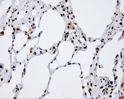 TLDC1 / KIAA1609 Antibody - IHC of paraffin-embedded lung tissue using anti-KIAA1609 mouse monoclonal antibody. (Heat-induced epitope retrieval by 10mM citric buffer, pH6.0, 100C for 10min, Dilution 1:50).