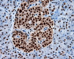 TLDC1 / KIAA1609 Antibody - IHC of paraffin-embedded pancreas tissue using anti-KIAA1609 mouse monoclonal antibody. (Heat-induced epitope retrieval by 10mM citric buffer, pH6.0, 100C for 10min, Dilution 1:50).