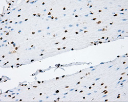 TLDC1 / KIAA1609 Antibody - IHC of paraffin-embedded colon tissue using anti-KIAA1609 mouse monoclonal antibody. (Heat-induced epitope retrieval by 10mM citric buffer, pH6.0, 100C for 10min, Dilution 1:50).