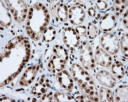 TLDC1 / KIAA1609 Antibody - IHC of paraffin-embedded Kidney tissue using anti-KIAA1609 mouse monoclonal antibody. (Heat-induced epitope retrieval by 10mM citric buffer, pH6.0, 100C for 10min, Dilution 1:50).
