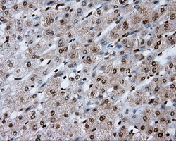 TLDC1 / KIAA1609 Antibody - IHC of paraffin-embedded liver tissue using anti-KIAA1609 mouse monoclonal antibody. (Heat-induced epitope retrieval by 10mM citric buffer, pH6.0, 100C for 10min, Dilution 1:50).