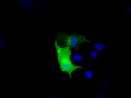 TLDC1 / KIAA1609 Antibody - Anti-KIAA1609 mouse monoclonal antibody immunofluorescent staining of COS7 cells transiently transfected by pCMV6-ENTRY KIAA1609.