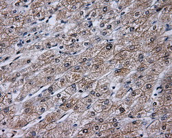 TLDC1 / KIAA1609 Antibody - IHC of paraffin-embedded Human liver tissue using anti-KIAA1609 mouse monoclonal antibody.