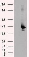 TLDC1 / KIAA1609 Antibody - HEK293T cells were transfected with the pCMV6-ENTRY control (Left lane) or pCMV6-ENTRY KIAA1609 (Right lane) cDNA for 48 hrs and lysed. Equivalent amounts of cell lysates (5 ug per lane) were separated by SDS-PAGE and immunoblotted with anti-KIAA1609.