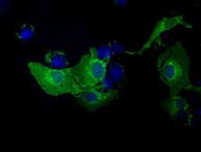 TLDC1 / KIAA1609 Antibody - Anti-KIAA1609 mouse monoclonal antibody immunofluorescent staining of COS7 cells transiently transfected by pCMV6-ENTRY KIAA1609.