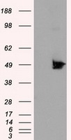 TLDC1 / KIAA1609 Antibody - HEK293T cells were transfected with the pCMV6-ENTRY control (Left lane) or pCMV6-ENTRY KIAA1609 (Right lane) cDNA for 48 hrs and lysed. Equivalent amounts of cell lysates (5 ug per lane) were separated by SDS-PAGE and immunoblotted with anti-KIAA1609.