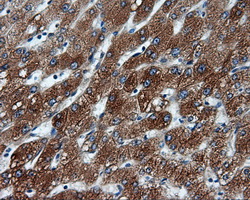 TLDC1 / KIAA1609 Antibody - IHC of paraffin-embedded liver tissue using anti-KIAA1609 mouse monoclonal antibody. (Dilution 1:50).