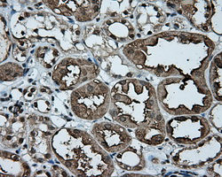 TLDC1 / KIAA1609 Antibody - IHC of paraffin-embedded Kidney tissue using anti-KIAA1609 mouse monoclonal antibody. (Dilution 1:50).