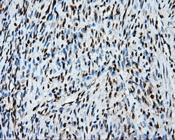 TLDC1 / KIAA1609 Antibody - IHC of paraffin-embedded endometrium tissue using anti-KIAA1609 mouse monoclonal antibody. (Dilution 1:50).