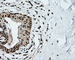TLDC1 / KIAA1609 Antibody - IHC of paraffin-embedded breast tissue using anti-KIAA1609 mouse monoclonal antibody. (Dilution 1:50).
