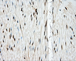 TLDC1 / KIAA1609 Antibody - IHC of paraffin-embedded colon tissue using anti-KIAA1609 mouse monoclonal antibody. (Dilution 1:50).
