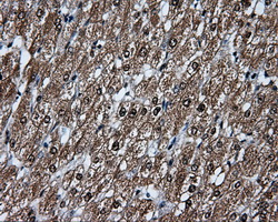 TLDC1 / KIAA1609 Antibody - IHC of paraffin-embedded liver tissue using anti-KIAA1609 mouse monoclonal antibody. (Dilution 1:50).