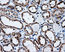 TLDC1 / KIAA1609 Antibody - IHC of paraffin-embedded Kidney tissue using anti-KIAA1609 mouse monoclonal antibody. (Dilution 1:50).