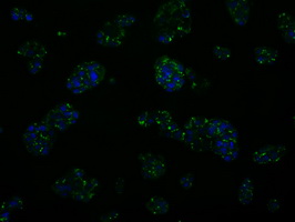 TLDC1 / KIAA1609 Antibody - Immunofluorescent staining of HepG2 cells using anti-KIAA1609 mouse monoclonal antibody.