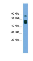 TLDC1 / KIAA1609 Antibody - KIAA1609 antibody Western blot of Transfected 293T cell lysate. This image was taken for the unconjugated form of this product. Other forms have not been tested.