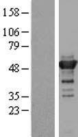 TLDC1 / KIAA1609 Protein - Western validation with an anti-DDK antibody * L: Control HEK293 lysate R: Over-expression lysate