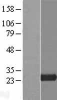 TLDC2 / C20orf118 Protein - Western validation with an anti-DDK antibody * L: Control HEK293 lysate R: Over-expression lysate