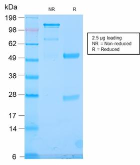 TLE1 / TLE 1 Antibody - SDS-PAGE Analysis Purified TLE1 Rabbit Recombinant Monoclonal Antibody (TLE1/2946R). Confirmation of Purity and Integrity of Antibody.