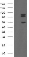 TLE1 / TLE 1 Antibody - HEK293T cells were transfected with the pCMV6-ENTRY control (Left lane) or pCMV6-ENTRY TLE1 (Right lane) cDNA for 48 hrs and lysed. Equivalent amounts of cell lysates (5 ug per lane) were separated by SDS-PAGE and immunoblotted with anti-TLE1.