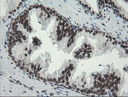 TLE1 / TLE 1 Antibody - IHC of paraffin-embedded Human prostate tissue using anti-TLE1 mouse monoclonal antibody.
