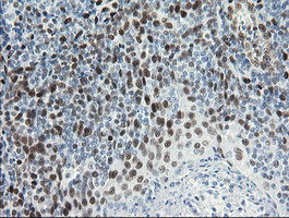 TLE1 / TLE 1 Antibody - IHC of paraffin-embedded Human tonsil using anti-TLE1 mouse monoclonal antibody.