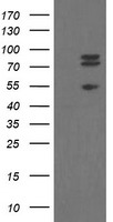 TLE1 / TLE 1 Antibody - HEK293T cells were transfected with the pCMV6-ENTRY control. (Left lane) or pCMV6-ENTRY TLE1. (Right lane) cDNA for 48 hrs and lysed. Equivalent amounts of cell lysates. (5 ug per lane) were separated by SDS-PAGE and immunoblotted with anti-TLE1. (1:2000)