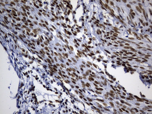 TLE1 / TLE 1 Antibody - Immunohistochemical staining of paraffin-embedded Human endometrium tissue within the normal limits using anti-TLE1 mouse monoclonal antibody. (Heat-induced epitope retrieval by 1mM EDTA in 10mM Tris buffer. (pH8.0) at 120°C for 2.5 min. (1:300)