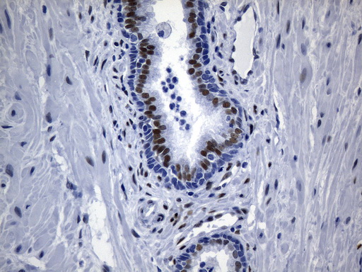 TLE1 / TLE 1 Antibody - Immunohistochemical staining of paraffin-embedded Human prostate tissue within the normal limits using anti-TLE1 mouse monoclonal antibody. (Heat-induced epitope retrieval by 1mM EDTA in 10mM Tris buffer. (pH8.0) at 120°C for 2.5 min. (1:300)