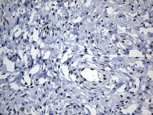 TLE1 / TLE 1 Antibody - Immunohistochemical staining of paraffin-embedded Human cervix uterus within the normal limits using anti-TLE1 mouse monoclonal antibody. (Heat-induced epitope retrieval by Tris-EDTAin 10mM Tris buffer. (pH8.0) at 120°C for 2.5 min. (1:300)