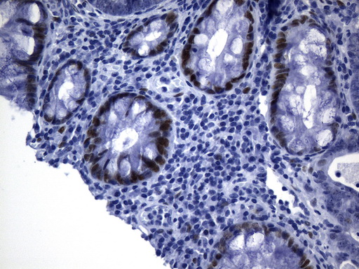 TLE1 / TLE 1 Antibody - Immunohistochemical staining of paraffin-embedded Human colon tissue within the normal limits using anti-TLE1 mouse monoclonal antibody. (Heat-induced epitope retrieval by 1mM EDTA in 10mM Tris buffer. (pH8.0) at 120°C for 2.5 min. (1:300)