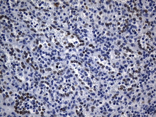 TLE1 / TLE 1 Antibody - Immunohistochemical staining of paraffin-embedded Human spleen tissue within the normal limits using anti-TLE1 mouse monoclonal antibody. (Heat-induced epitope retrieval by 1mM EDTA in 10mM Tris buffer. (pH8.0) at 120°C for 2.5 min. (1:300)