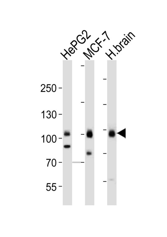 TLE1 / TLE 1 Antibody - Western blot of lysates from HepG2, MCF-7 cell line and human brain tissue (from left to right), using TLE1 antibody diluted at 1:1000 at each lane. A goat anti-rabbit IgG H&L (HRP) at 1:10000 dilution was used as the secondary antibody. Lysates at 20 ug per lane.