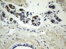 TLE1 / TLE 1 Antibody - IHC of paraffin-embedded Human breast tissue using anti-TLE1 mouse monoclonal antibody.