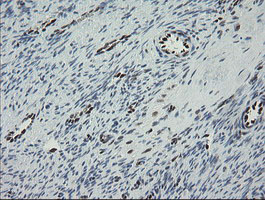 TLE1 / TLE 1 Antibody - IHC of paraffin-embedded Human Ovary tissue using anti-TLE1 mouse monoclonal antibody.