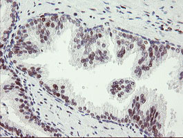 TLE1 / TLE 1 Antibody - IHC of paraffin-embedded Human prostate tissue using anti-TLE1 mouse monoclonal antibody.
