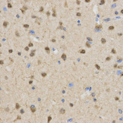 TLE1 / TLE 1 Antibody - Immunohistochemistry of paraffin-embedded mouse brain using TLE1 antibody at dilution of 1:200 (x400 lens).