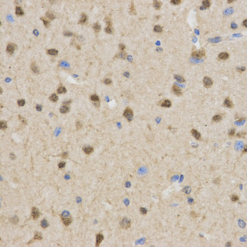 TLE1 / TLE 1 Antibody - Immunohistochemistry of paraffin-embedded mouse brain using TLE1 antibody at dilution of 1:200 (x400 lens).