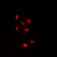 TLE1 / TLE 1 Antibody - Immunofluorescent analysis of TLE1 staining in U2OS cells. Formalin-fixed cells were permeabilized with 0.1% Triton X-100 in TBS for 5-10 minutes and blocked with 3% BSA-PBS for 30 minutes at room temperature. Cells were probed with the primary antibody in 3% BSA-PBS and incubated overnight at 4 deg C in a humidified chamber. Cells were washed with PBST and incubated with a DyLight 594-conjugated secondary antibody (red) in PBS at room temperature in the dark.
