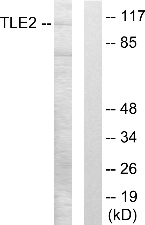 TLE2 Antibody - Western blot analysis of lysates from LOVO cells, using TLE2 Antibody. The lane on the right is blocked with the synthesized peptide.