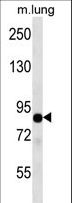 TLE2 Antibody - TLE2 Antibody western blot of mouse lung tissue lysates (35 ug/lane). The TLE2 antibody detected the TLE2 protein (arrow).
