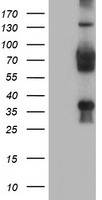 TLE2 Antibody - HEK293T cells were transfected with the pCMV6-ENTRY control (Left lane) or pCMV6-ENTRY TLE2 (Right lane) cDNA for 48 hrs and lysed. Equivalent amounts of cell lysates (5 ug per lane) were separated by SDS-PAGE and immunoblotted with anti-TLE2.