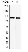 TLE2 Antibody - Western blot analysis of TLE2 expression in HeLa (A); Jurkat (B) whole cell lysates.